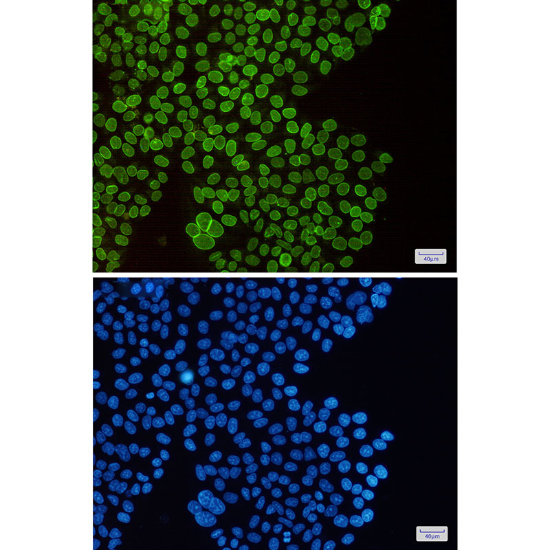 2 - SUN1 Rabbit mAb AP76134