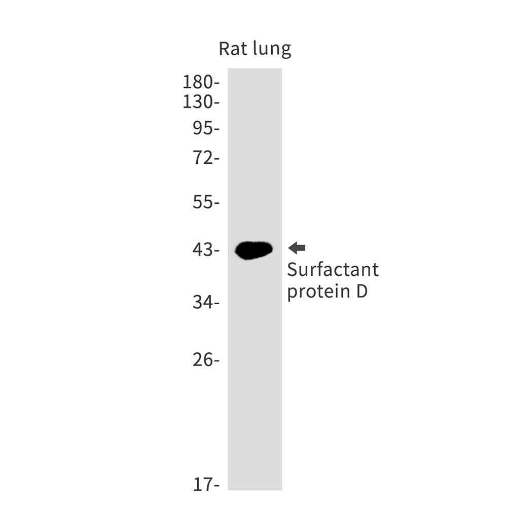 1 - Pulmonary Surfactant Associated Protein D Rabbit mAb AP76137