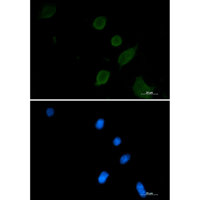 1 - Synaptophysin Rabbit mAb AP76139