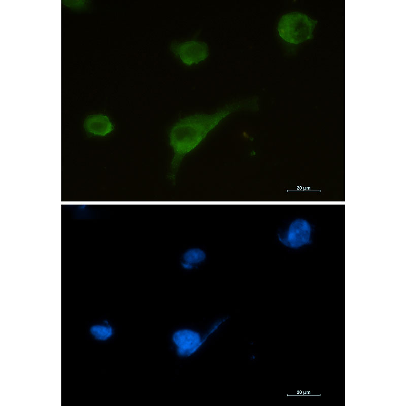 1 - Syntrophin alpha 1 Rabbit mAb AP76143