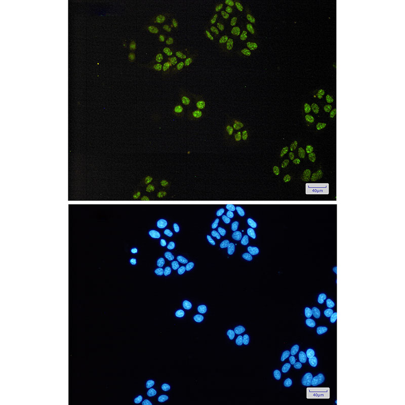 8 - [KO]TAF15 Rabbit mAb AP76146