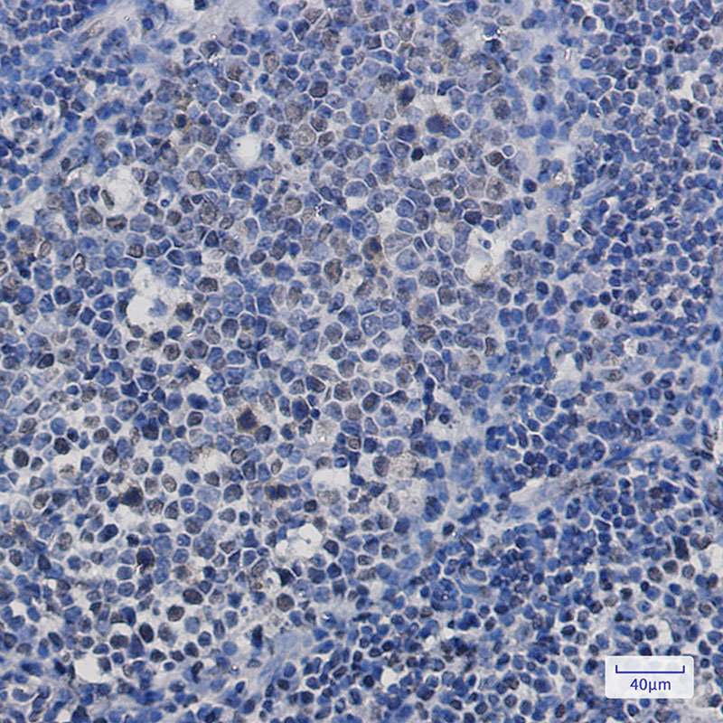 4 - [KO]TAF15 Rabbit mAb AP76146