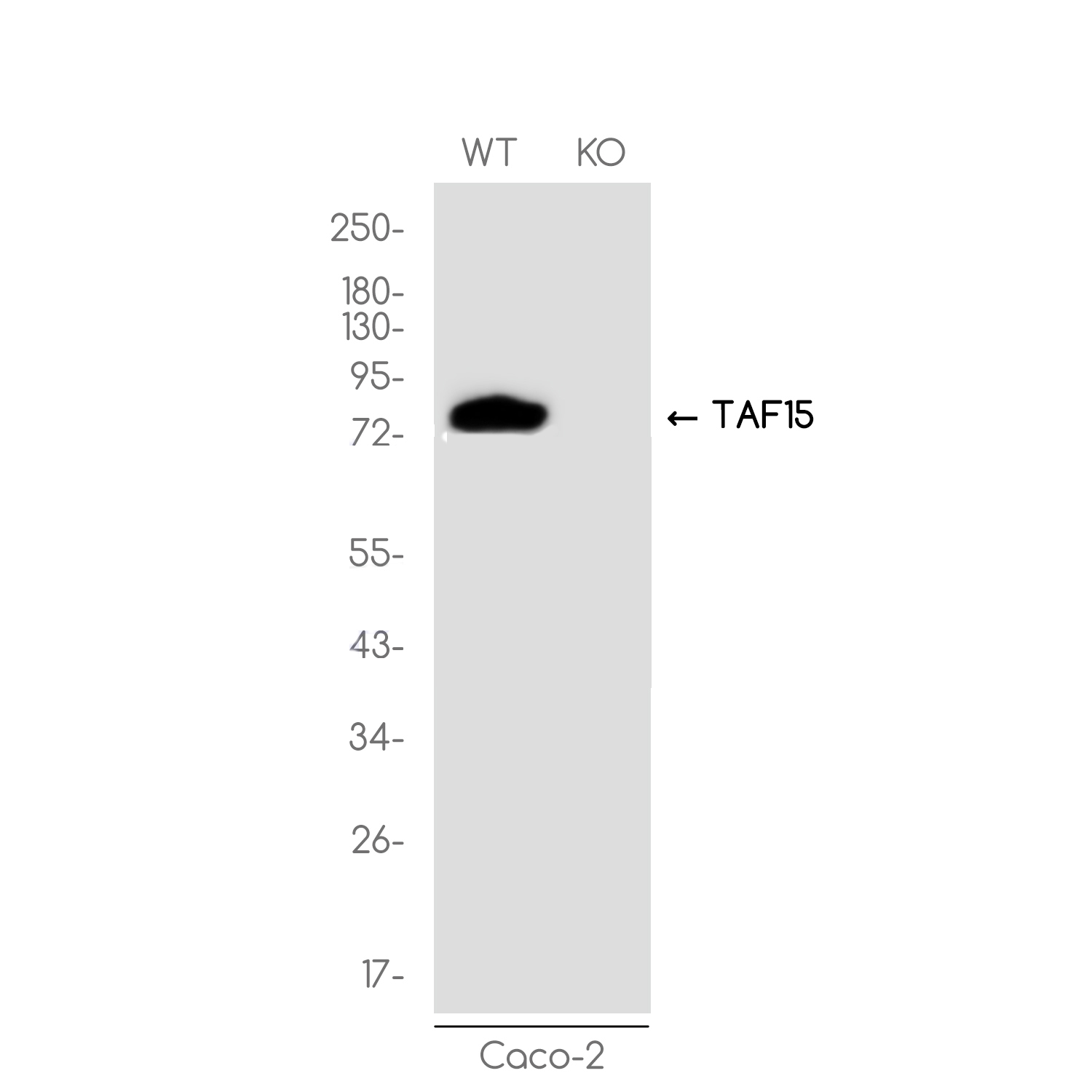 1 - [KO]TAF15 Rabbit mAb AP76146