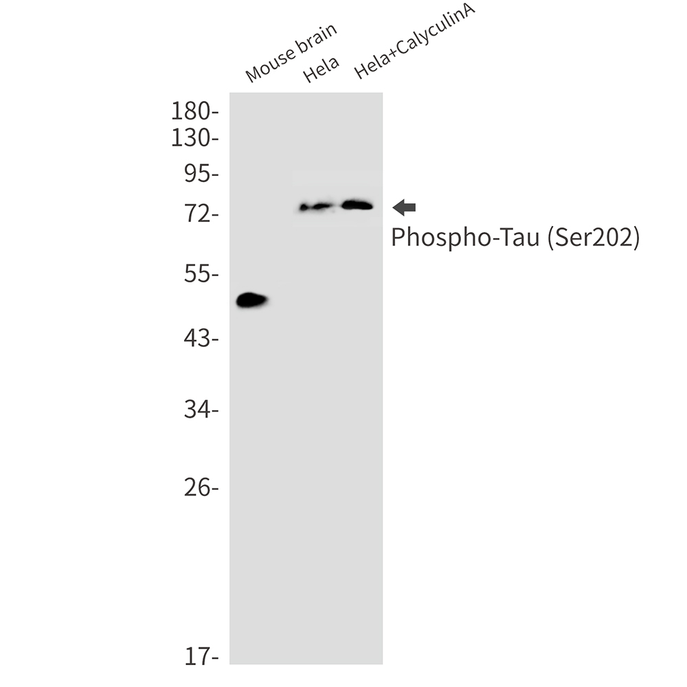 1 - Phospho-Tau (Ser202) Rabbit mAb AP76151