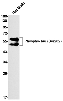 0 - Phospho-Tau (Ser202) Rabbit mAb AP76151