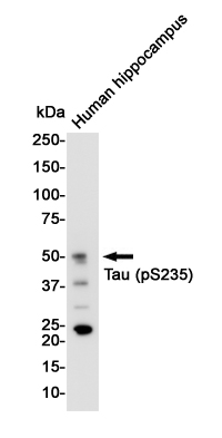 1 - Phospho-Tau (Ser235) Rabbit mAb AP76152