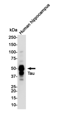 3 - Phospho-Tau (Thr50) Rabbit mAb AP76153