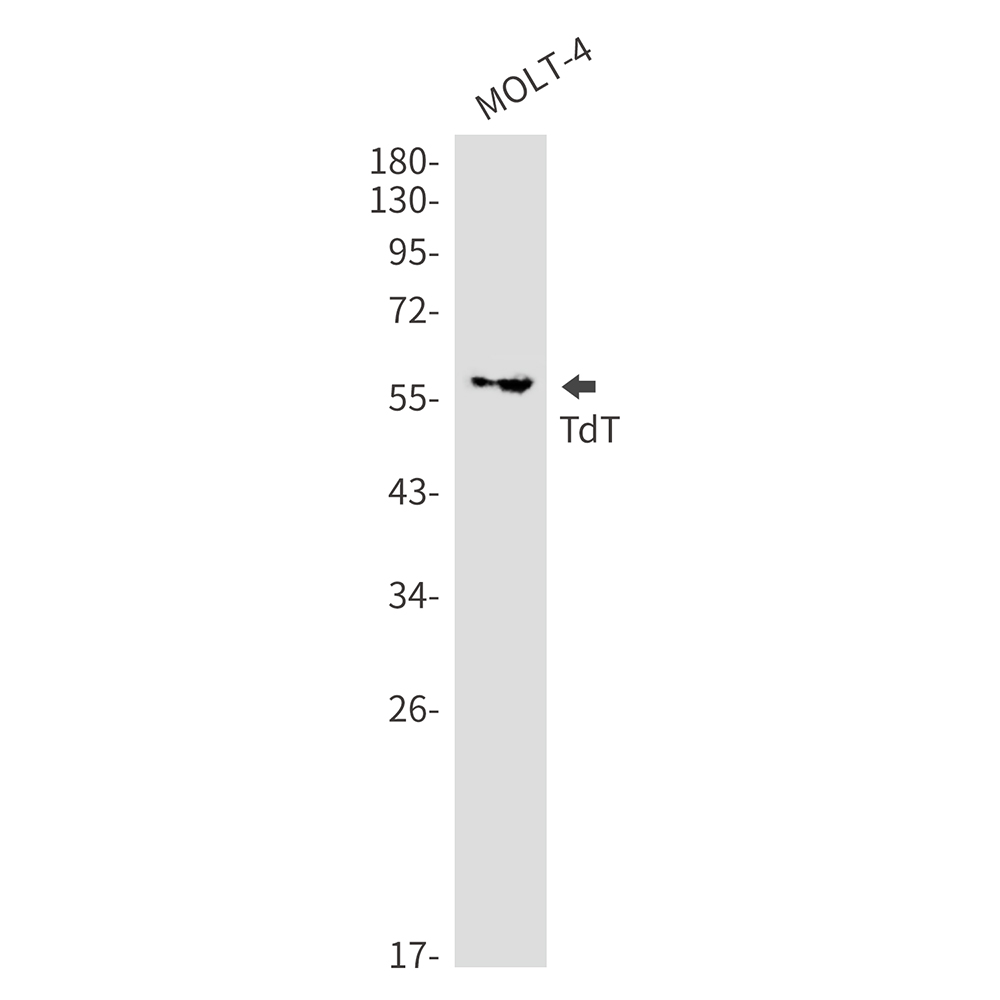 1 - TdT Rabbit mAb AP76164