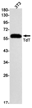 8 - TdT Rabbit mAb AP76164