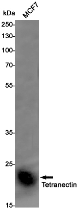 2 - Tetranectin Rabbit mAb AP76168