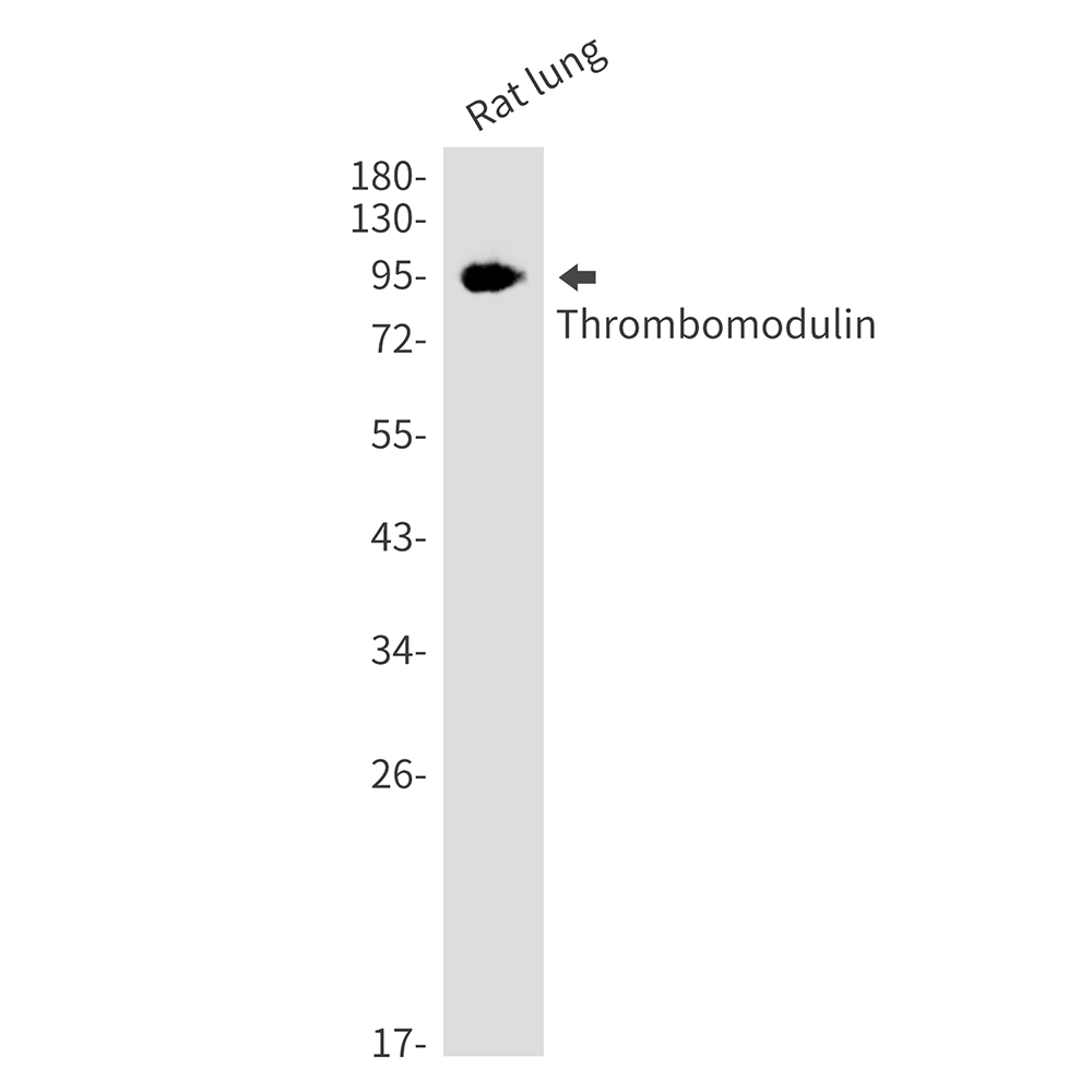 1 - Thrombomodulin Rabbit mAb AP76172