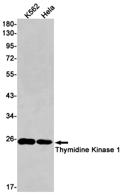 1 - TK1 Rabbit mAb AP76173