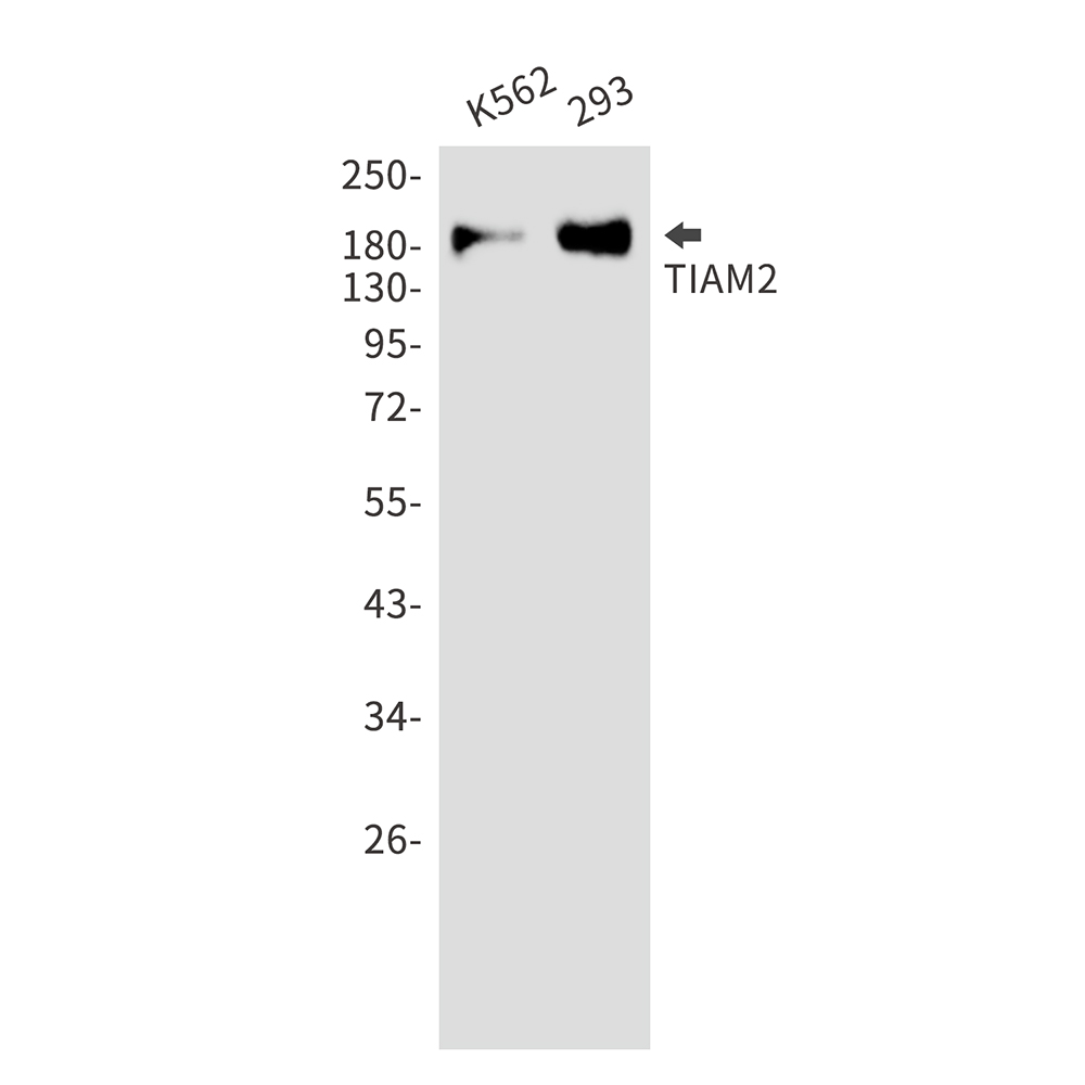 1 - TIAM2 Rabbit mAb AP76175