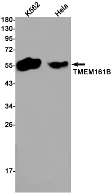 1 - Transmembrane Protein 161B Rabbit mAb AP76178