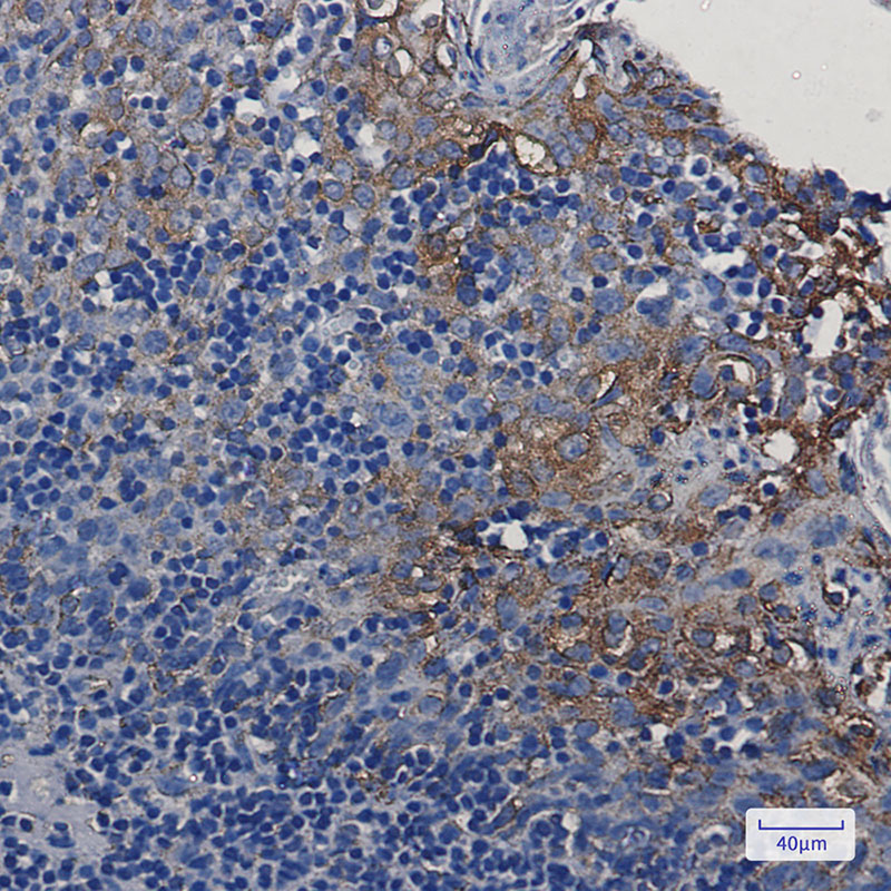 2 - STING Rabbit mAb AP76179