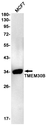 1 - Transmembrane Protein 30B Rabbit mAb AP76182