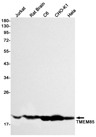 2 - Transmembrane Protein 85 Rabbit mAb AP76184