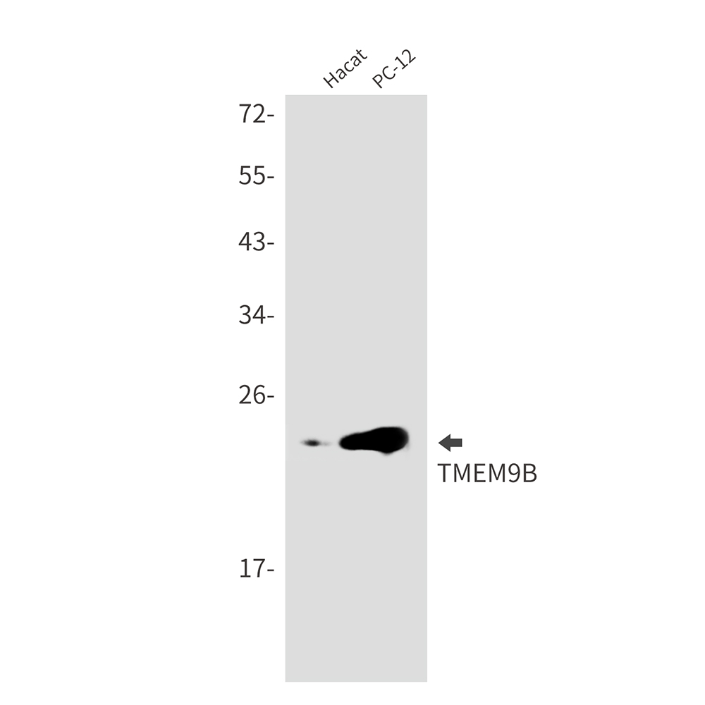 1 - TMEM9B Rabbit mAb AP76185