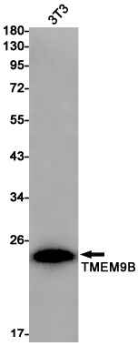 8 - TMEM9B Rabbit mAb AP76185