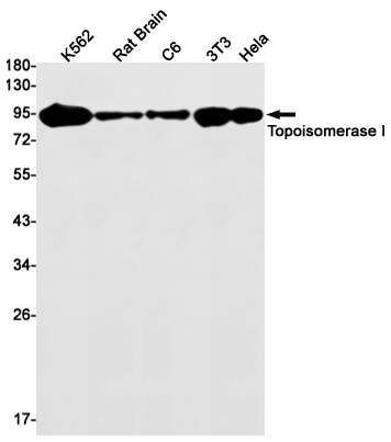 1 - Topoisomerase I Rabbit mAb AP76188