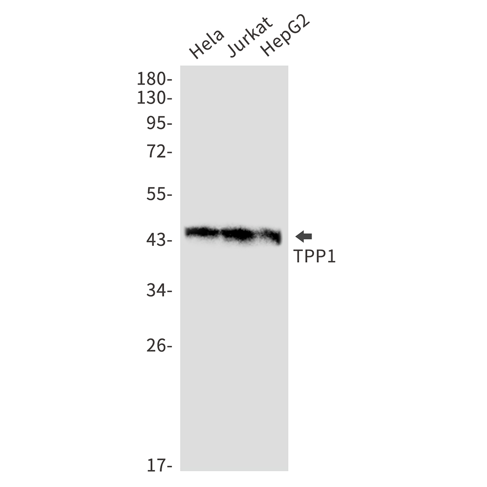1 - TPP1 Rabbit mAb AP76190