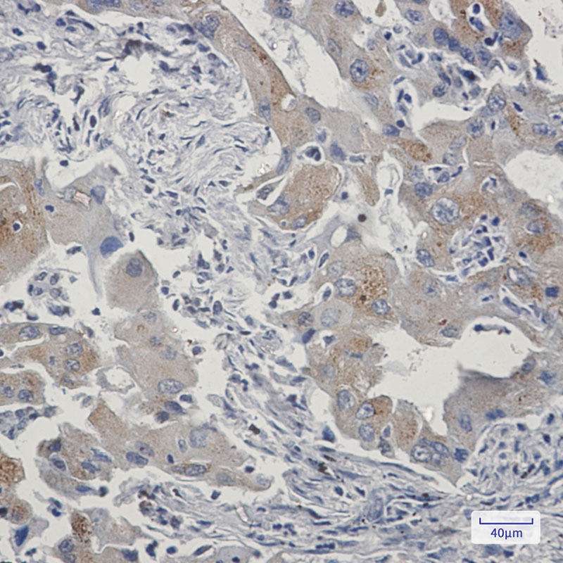 8 - TAX1BP1 Rabbit mAb AP76193