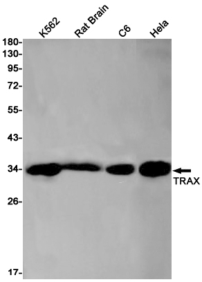 8 - Translin Associated Protein X Rabbit mAb AP76197
