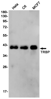 2 - TARBP2 Rabbit mAb AP76198