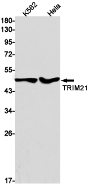 1 - TRIM21 Rabbit mAb AP76201