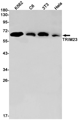 1 - TRIM23/ARD1 Rabbit mAb AP76202