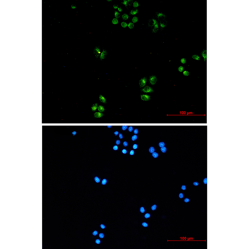 8 - TFG Rabbit mAb AP76205
