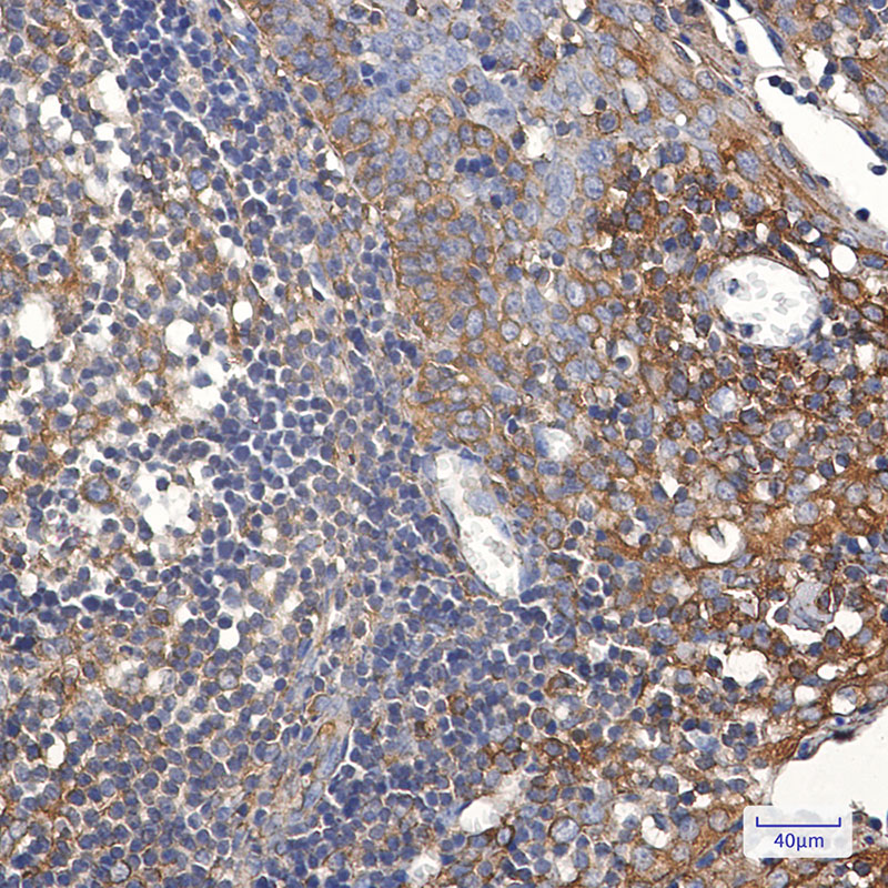 2 - TFG Rabbit mAb AP76205