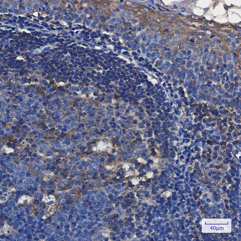 2 - TFG Rabbit mAb AP76206