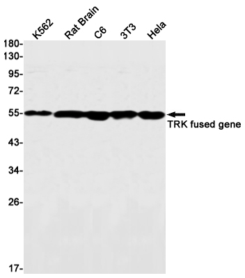 1 - TFG Rabbit mAb AP76206