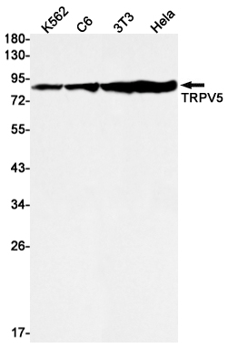 1 - TrpV5 Rabbit mAb AP76207