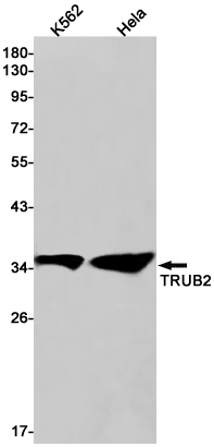 1 - TRUB2 Rabbit mAb AP76208