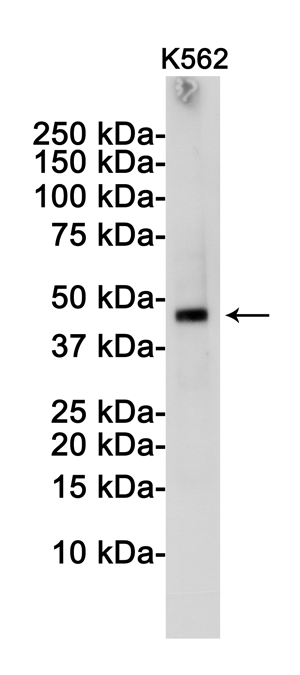 1 - TSG101 Rabbit mAb AP76209