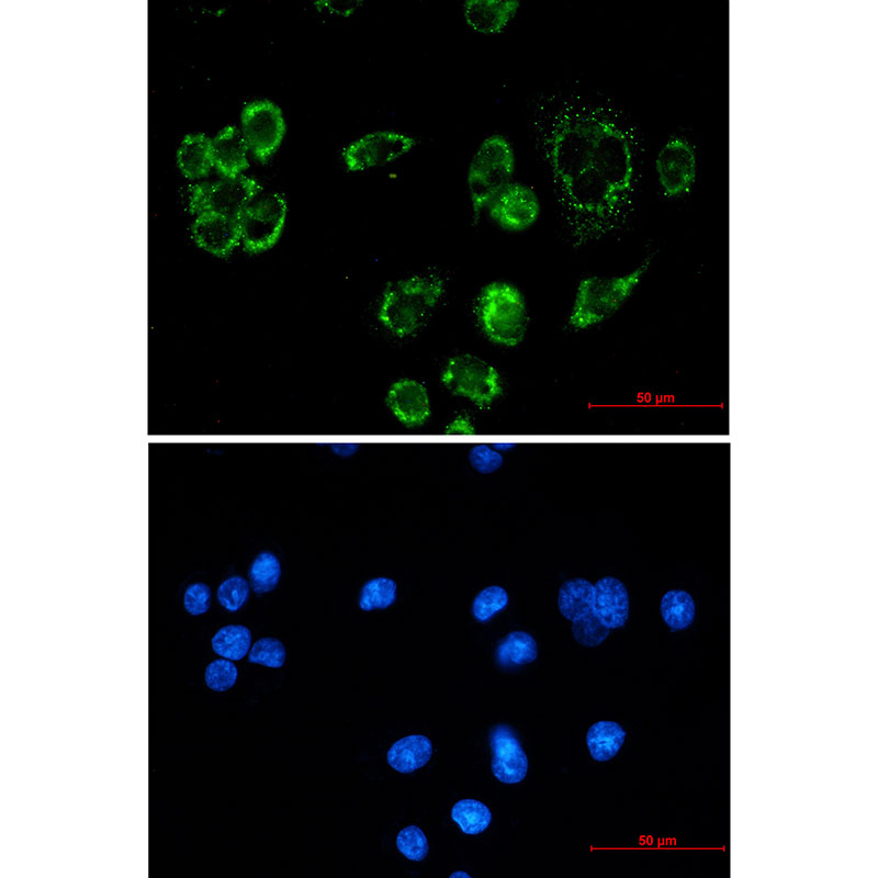 8 - TTC11/FIS1 Protein Rabbit mAb AP76211