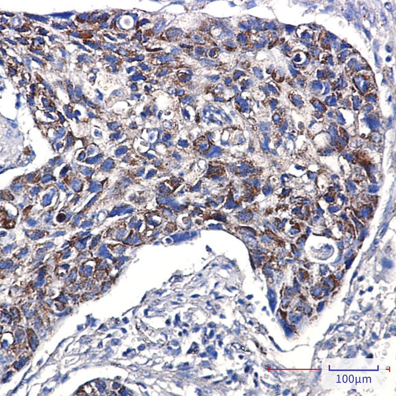 2 - TTC11/FIS1 Protein Rabbit mAb AP76211