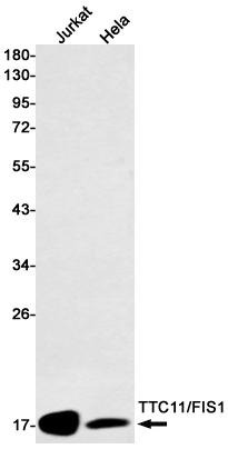 1 - TTC11/FIS1 Protein Rabbit mAb AP76211