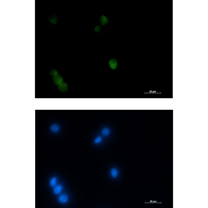 1 - Thyroid Transcription Factor 1 Rabbit mAb AP76212