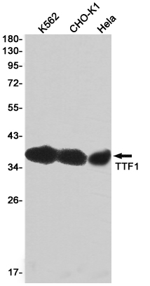 2 - Thyroid Transcription Factor 1 Rabbit mAb AP76212