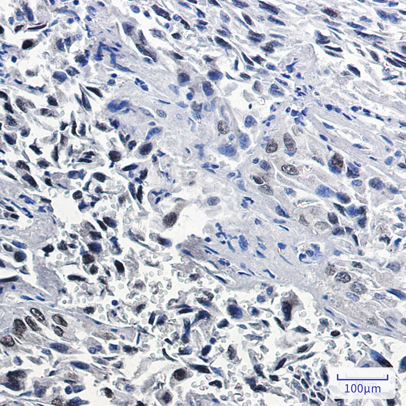 4 - [KO]Thyroid Transcription Factor 1 Rabbit mAb AP76213
