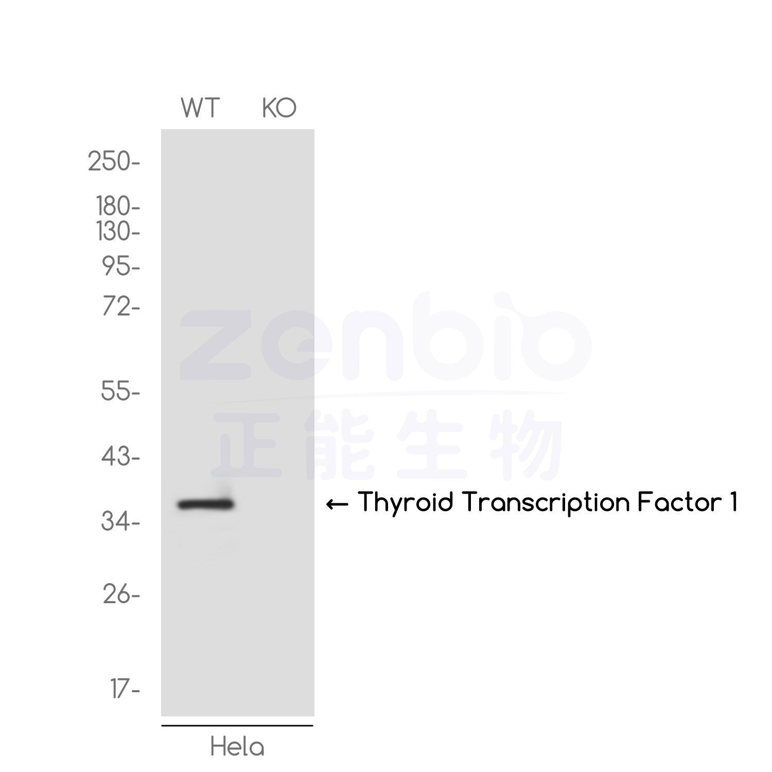 1 - [KO]Thyroid Transcription Factor 1 Rabbit mAb AP76213