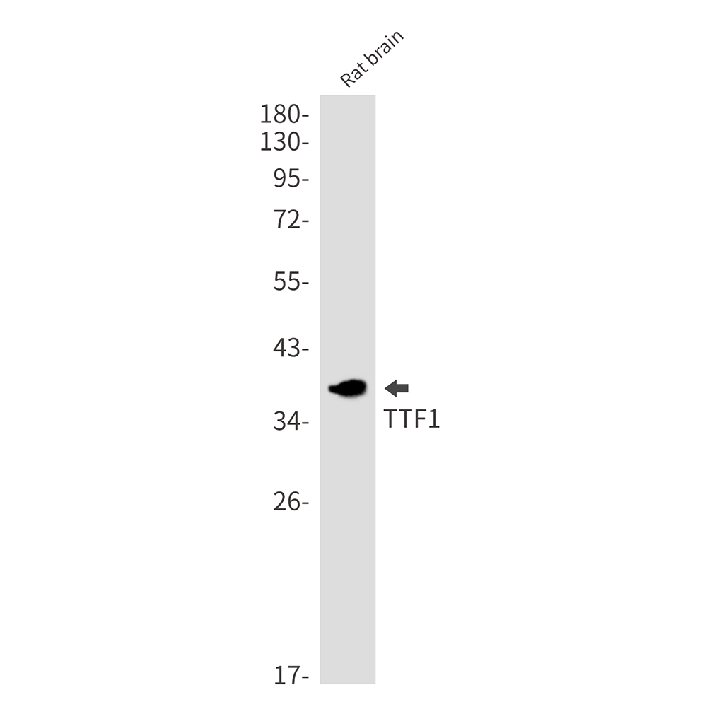 2 - [KO]Thyroid Transcription Factor 1 Rabbit mAb AP76213