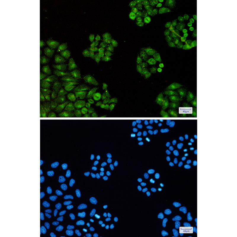 2 - Transcription Termination Factor 2/TTF2 Rabbit mAb AP76214