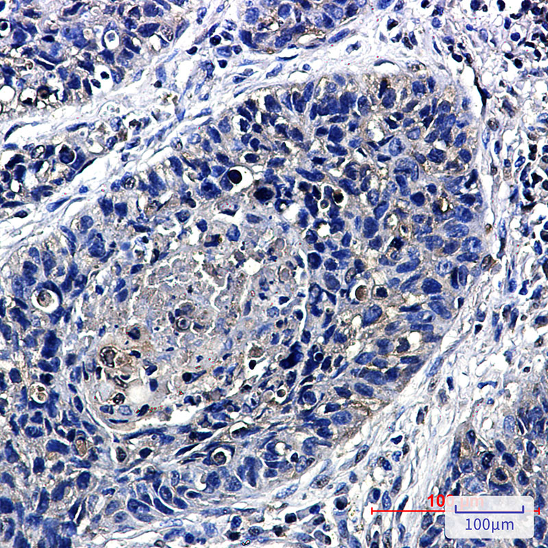 8 - Transcription Termination Factor 2/TTF2 Rabbit mAb AP76214