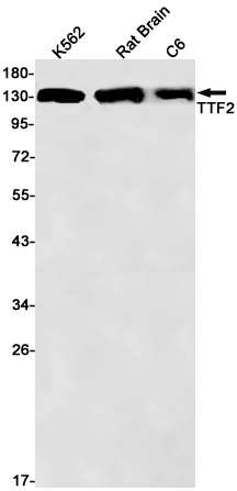 1 - Transcription Termination Factor 2/TTF2 Rabbit mAb AP76214
