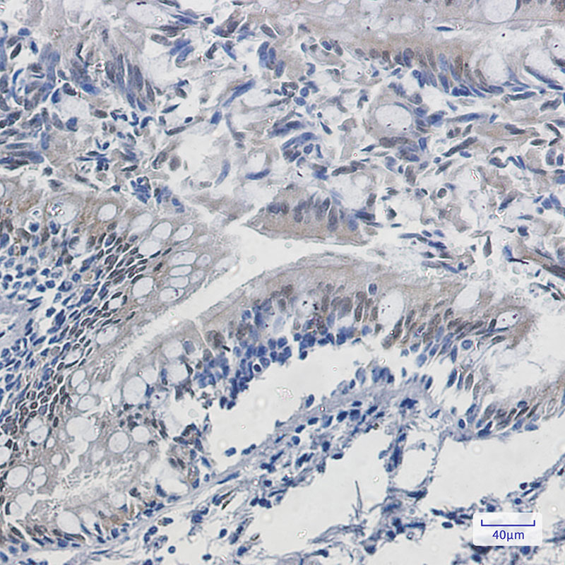 4 - TPPP Rabbit mAb AP76215