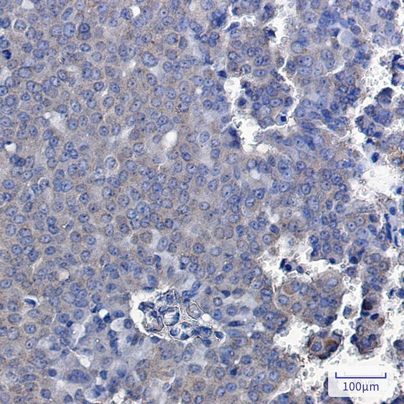 2 - TXNDC9 Rabbit mAb AP76216
